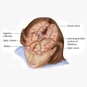 Neuro Ophthalmology